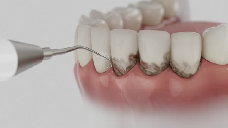 Reliable Dental Implants contractor in Racine, WI by Smile Center Dentistry